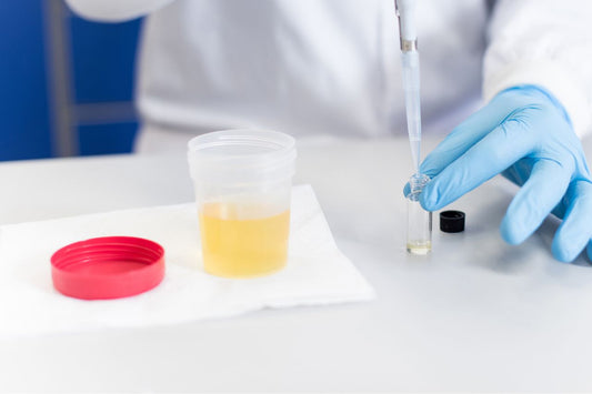 A doctor testing a urine sample
